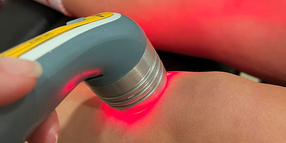 laser treatment in La Verne