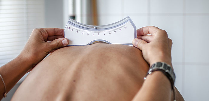 patient needing scoliosis treatment in La Verne