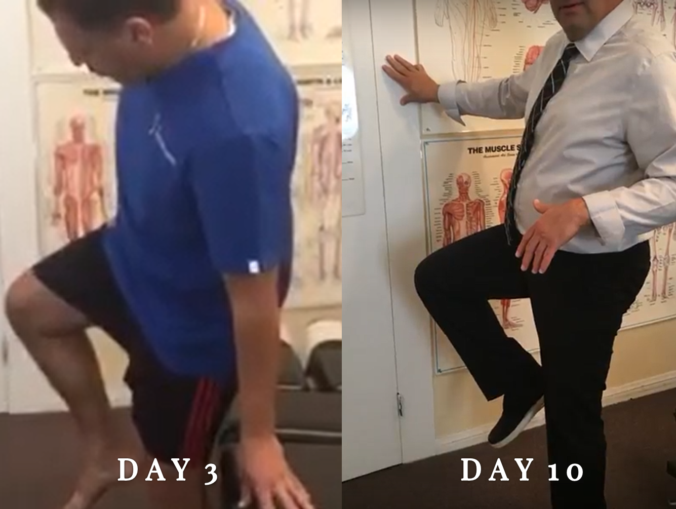 Knee Pain Treatment, Non-Invasive Approach tips from La Verne chiropractor