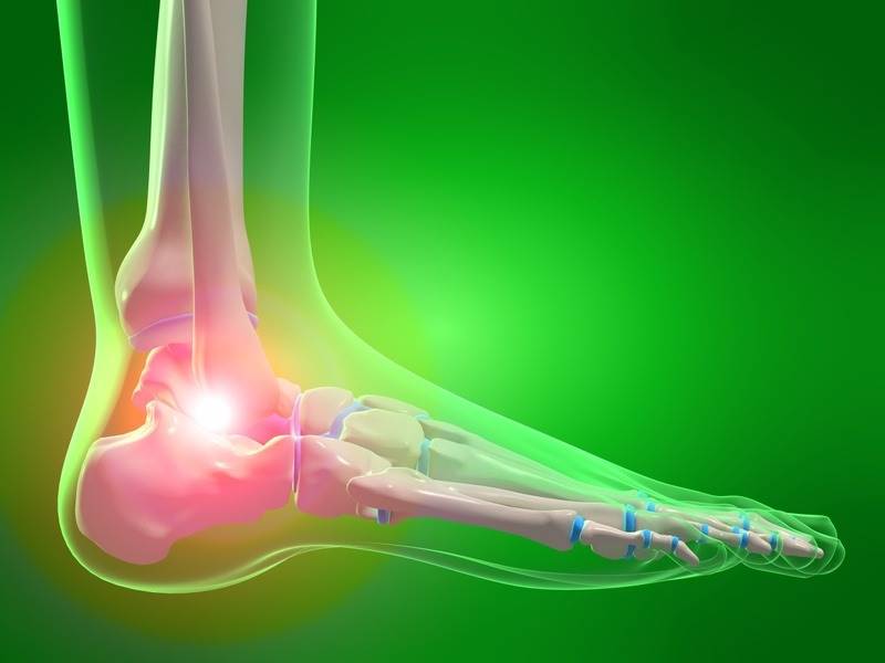 Plantar fasciitis tips from La Verne chiropractor